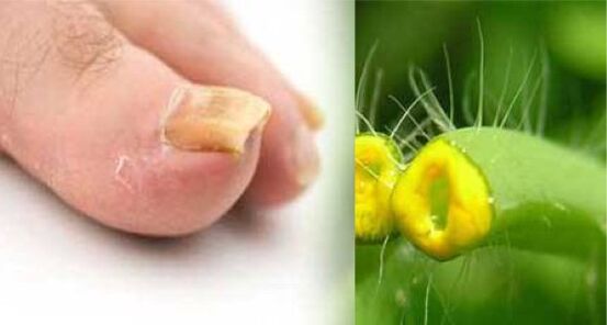 plantă de celandine pentru ciuperca unghiilor de la picioare