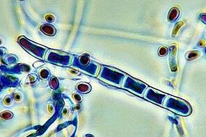 patogen al ciupercii unghiilor sub microscop